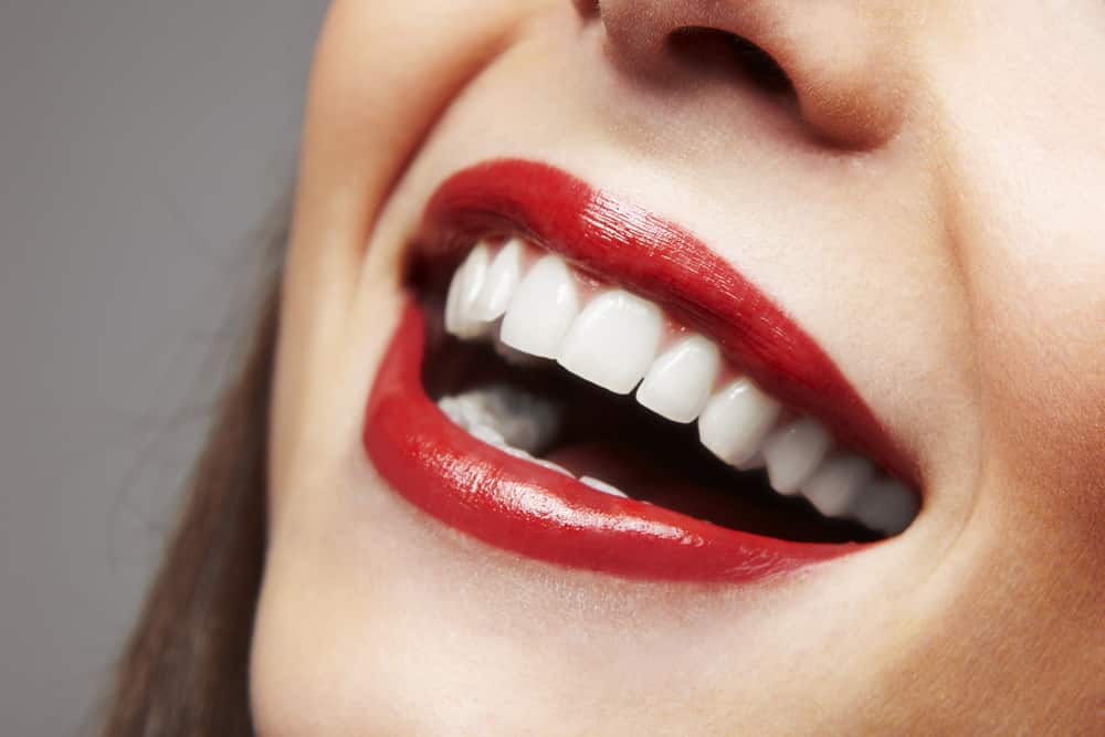 The Ultimate Smile Solution: Understanding Dental Implant Bridge Technology