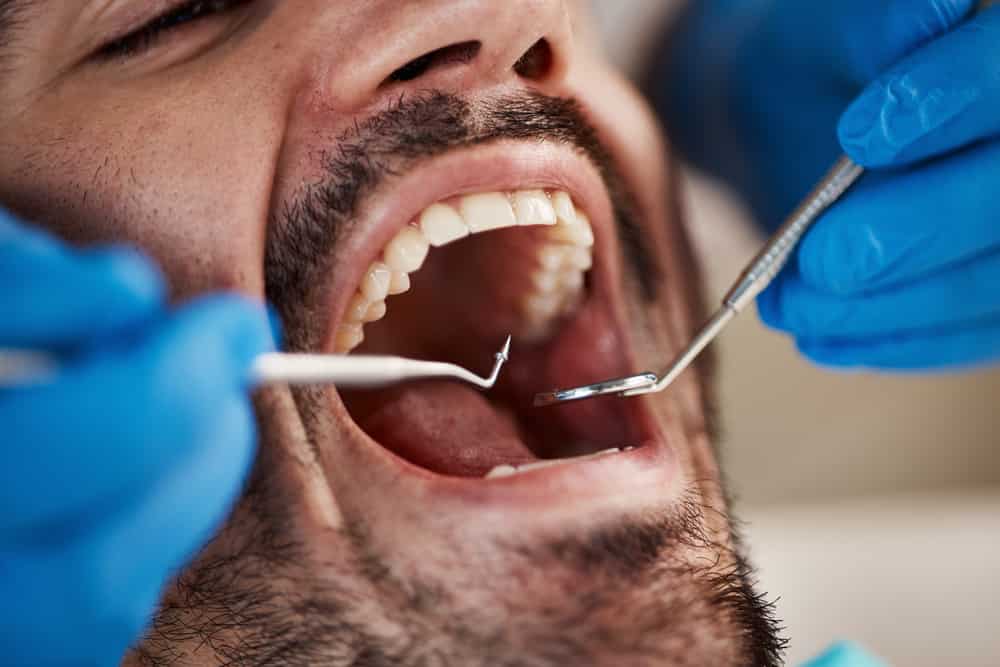Mouth, man and hands of dentist with tools for dental, healthcare or check in clinic. Oral wellness, orthodontics and patient with doctor, mirror and excavator for teeth cleaning and medical hygiene.
