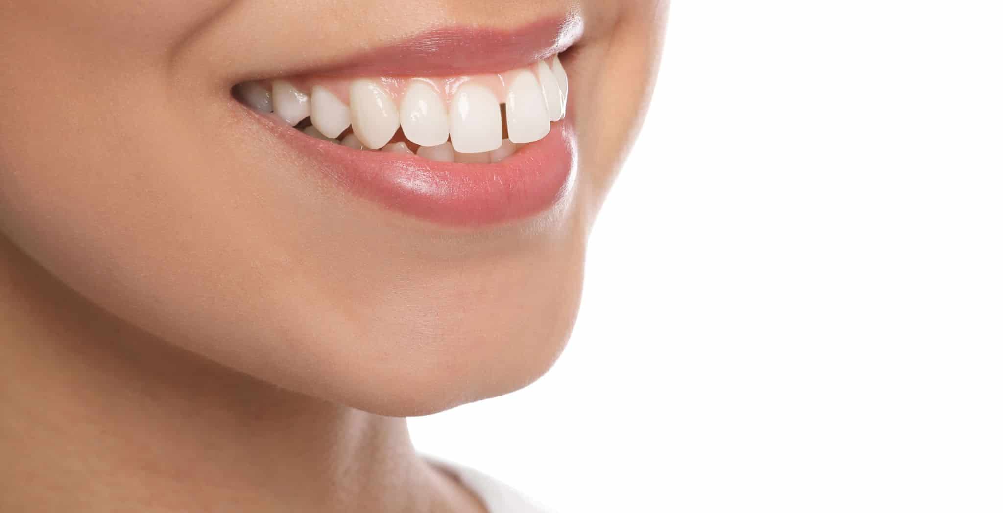 Does Invisalign fix overbite, Invisalign treatment for overbite, Correcting overbite with Invisalign, Invisalign for bite alignment, Overbite correction with clear aligners, Invisalign results for overbite,